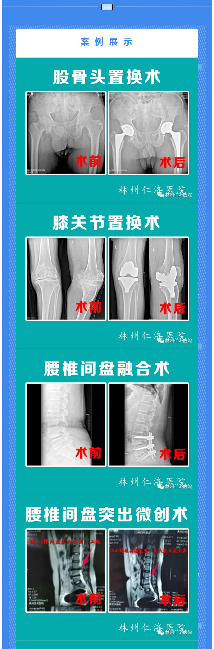 【仁济•新闻】林州仁济医院&郑州骨科医院-骨科专家义诊_02